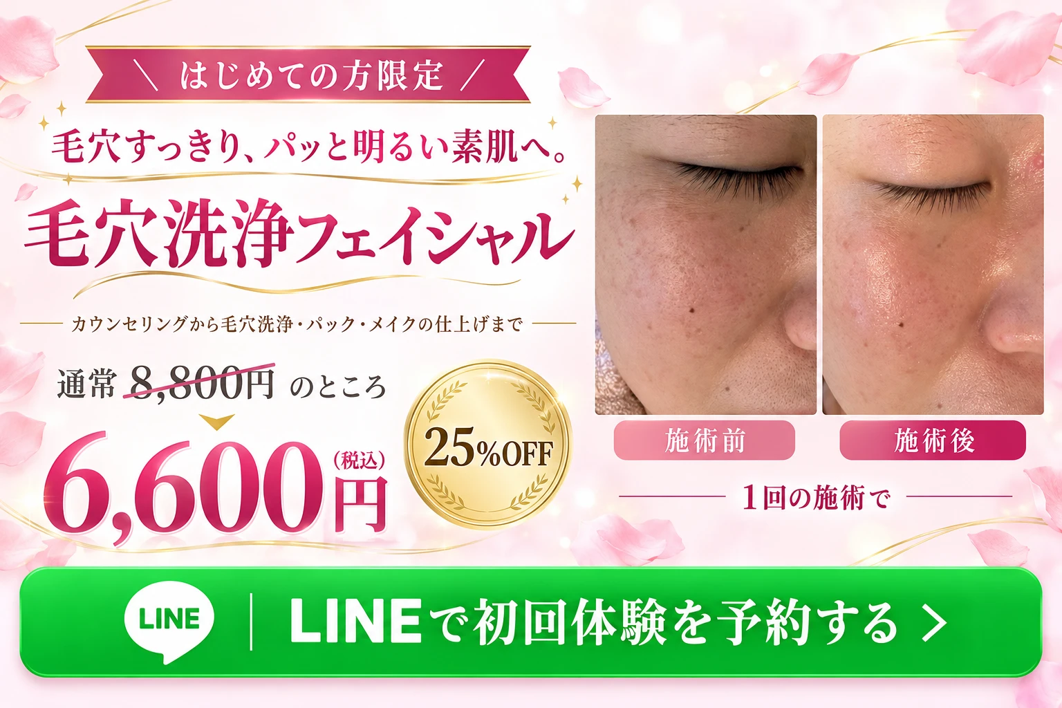 はじめての方限定 毛穴すっきり、パッと明るい素肌へ。毛穴洗浄フェイシャル カウンセリングから毛穴洗浄・パック・メイクの仕上げまで 通常8,800円のところ6,600円（税込）25%OFF 施術前と施術後 1回の施術で LINEで初回体験を予約する